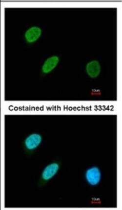BRF2 Antibody, Novus Biologicals 0.1mL; Unlabeled:Antibodies, Polyclonal