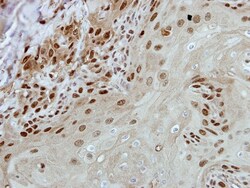 BRF2 Antibody, Novus Biologicals 0.1mL; Unlabeled:Antibodies, Polyclonal