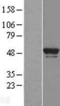 Novus Biologicals&trade;&nbsp;BRF2 Overexpression Lysate