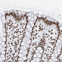 BRF2 Antibody, Novus Biologicals 0.1mL; Unlabeled:Antibodies, Polyclonal