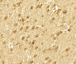 Brg1 Antibody - BSA Free, Novus Biologicals:Antibodies:Primary Antibodies