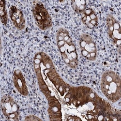 BRIX Antibody, Novus Biologicals 25 &mu;L; Unlabeled:Antibodies, Polyclonal
