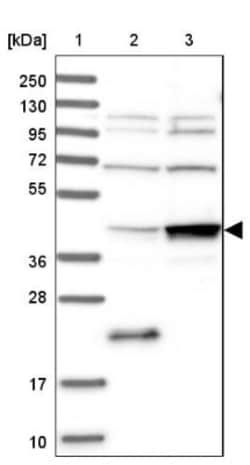 BRIX Antibody, Novus Biologicals 25 &mu;L; Unlabeled:Antibodies, Polyclonal