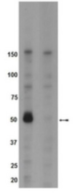 Brk, p Tyr342 Antibody, Novus Biologicals 0.025 mL; Unconjugated:Antibodies,