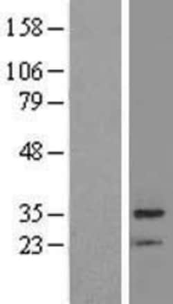 Novus Biologicals™ BRMS1 Overexpression Lysate