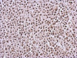 BRMS1L Antibody, Novus Biologicals 0.1mL; Unlabeled:Antibodies, Polyclonal