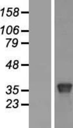 Novus Biologicals™ BRN4 Overexpression Lysate