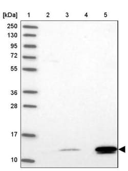 BRP44L Antibody, Novus Biologicals 25 &mu;L | Buy Online | Novus Biologicals | Fisher Scientific