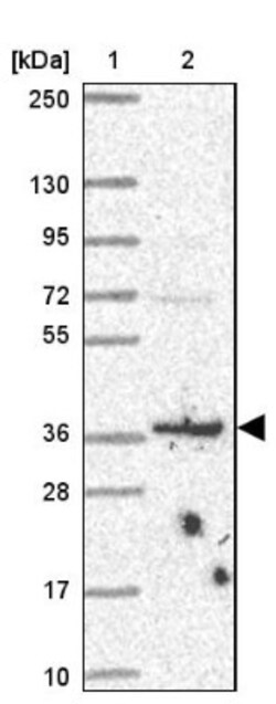 BRSK1 Antibody, Novus Biologicals 0.1mL; Unlabeled:Antibodies, Polyclonal