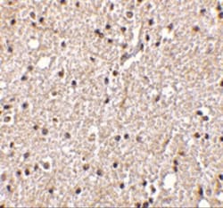 BRSK2 Antibody - BSA Free, Novus Biologicals 0.1mg; Unlabeled:Antibodies,