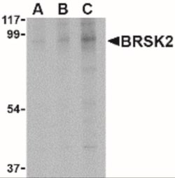 BRSK2 Antibody - BSA Free, Novus Biologicals 0.1mg; Unlabeled:Antibodies,