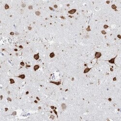 BRUNOL4 Antibody, Novus Biologicals:Antibodies:Primary Antibodies