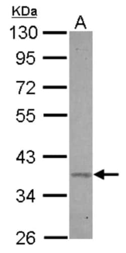 BRIX Antibody, Novus Biologicals 0.1mL; Unlabeled:Antibodies, Polyclonal