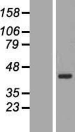 Novus Biologicals™ BRIX Overexpression Lysate