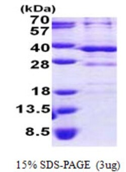 Novus Biologicals&trade;&nbsp;Recombinant Human BSND His Protein