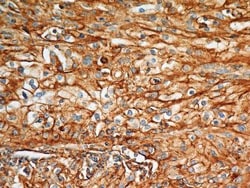 BST2 Antibody (2E2) - BSA Free, Novus Biologicals:Antibodies:Primary Antibodies