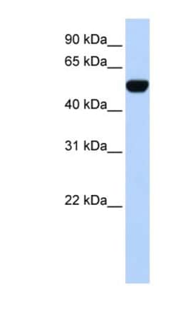 BTBD10 Antibody, Novus Biologicals:Antibodies:Primary Antibodies