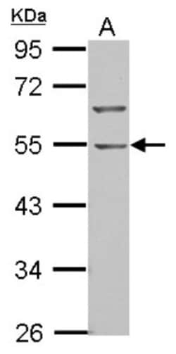 BTBD10 Antibody, Novus Biologicals 0.1mL; Unlabeled:Antibodies, Polyclonal