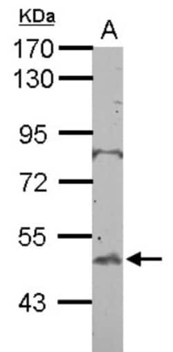 BTBD10 Antibody, Novus Biologicals 0.1mL; Unlabeled:Antibodies, Polyclonal
