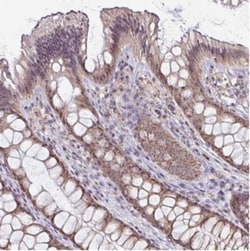 BTBD14A Antibody, Novus Biologicals 0.1mL; Unlabeled:Antibodies, Polyclonal