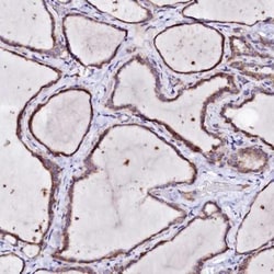 BTBD16 Antibody, Novus Biologicals 25 &mu;L, Unlabeled:Antibodies, Polyclonal