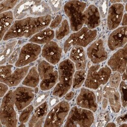 BTBD17 Antibody, Novus Biologicals 0.1mL; Unlabeled:Antibodies, Polyclonal