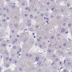BTBD19 Antibody, Novus Biologicals:Antibodies:Primary Antibodies