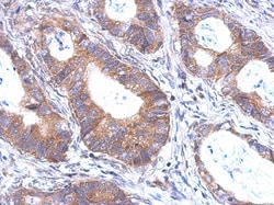 BTBD6 Antibody, Novus Biologicals 0.1mL; Unlabeled:Antibodies, Polyclonal