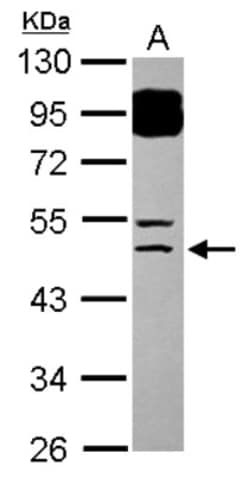 BTBD6 Antibody, Novus Biologicals 0.1mL; Unlabeled:Antibodies, Polyclonal