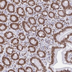 BTBD7 Antibody, Novus Biologicals:Antibodies:Primary Antibodies