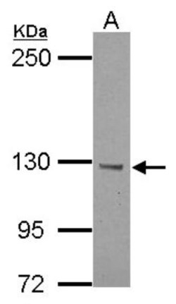 BTBD7 Antibody, Novus Biologicals 0.1mL; Unlabeled:Antibodies, Polyclonal