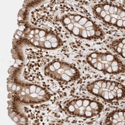 KIAA1107 Antibody, Novus Biologicals:Antibodies:Primary Antibodies