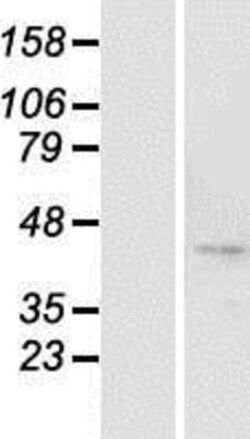 Novus Biologicals&trade;&nbsp;BTBD8 Overexpression Lysate