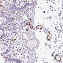 Biotinidase/BTD Antibody, Novus Biologicals 0.1mL; Unlabeled:Antibodies,
