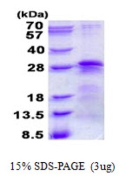 Novus Biologicals&trade;&nbsp;Recombinant Human BTF3 His Protein