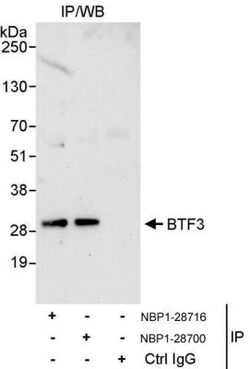 BTF3 Antibody, Novus Biologicals 0.1mg; Unlabeled:Antibodies, Polyclonal