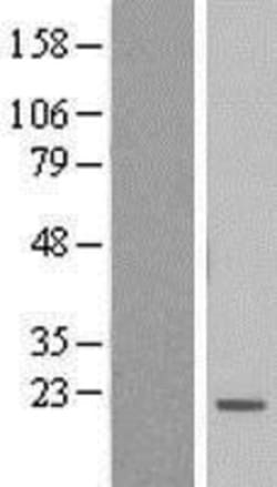 Novus Biologicals&trade;&nbsp;BTF3L4 Overexpression Lysate