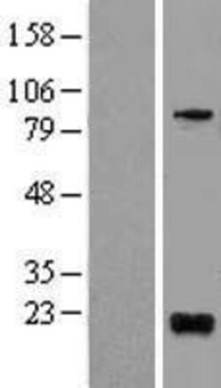 Novus Biologicals&trade;&nbsp;BTG1 Overexpression Lysate