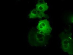 BTK Antibody (OTI3A2), Novus Biologicals 0.1mL; Unlabeled:Antibodies, Monoclonal