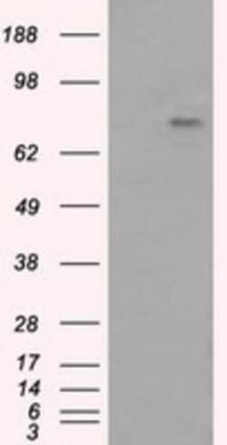 BTK Antibody (OTI3A2), Novus Biologicals 0.1mL; Unlabeled:Antibodies, Monoclonal