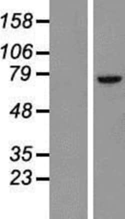 Novus Biologicals&trade;&nbsp;BTK Overexpression Lysate