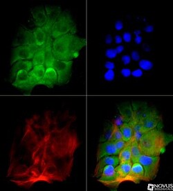 BTK Antibody (7F12H4) - BSA Free, Novus Biologicals 0.1mL; Unlabeled:Antibodies,