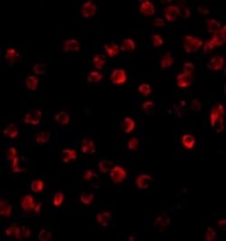 BTK Antibody - BSA Free, Novus Biologicals 0.025 mg, Unconjugated:Antibodies,