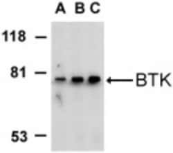 BTK Antibody - BSA Free, Novus Biologicals 0.025 mg, Unconjugated:Antibodies,