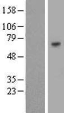 Novus Biologicals&trade;&nbsp;BTN2A2/Butyrophilin 2 Overexpression Lysate