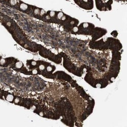 BTN3A3 Antibody, Novus Biologicals 25 &mu;L | Buy Online | Novus Biologicals | Fisher Scientific