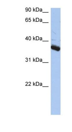 Bub3 Antibody, Novus Biologicals 100&mu;L; Unlabeled:Antibodies, Polyclonal