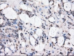BubR1 Antibody (OTI6E5), Novus Biologicals 0.1mL; Unlabeled:Antibodies,
