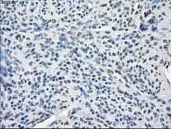 BubR1 Antibody (OTI6E5), Novus Biologicals 0.1mL; Unlabeled:Antibodies,