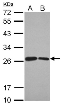BUD31 Antibody, Novus Biologicals 0.1mL; Unlabeled:Antibodies, Polyclonal